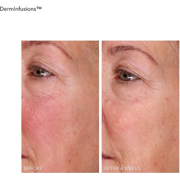 Dr Dennis Gross Derminfusion Lift Repair Eye Mask